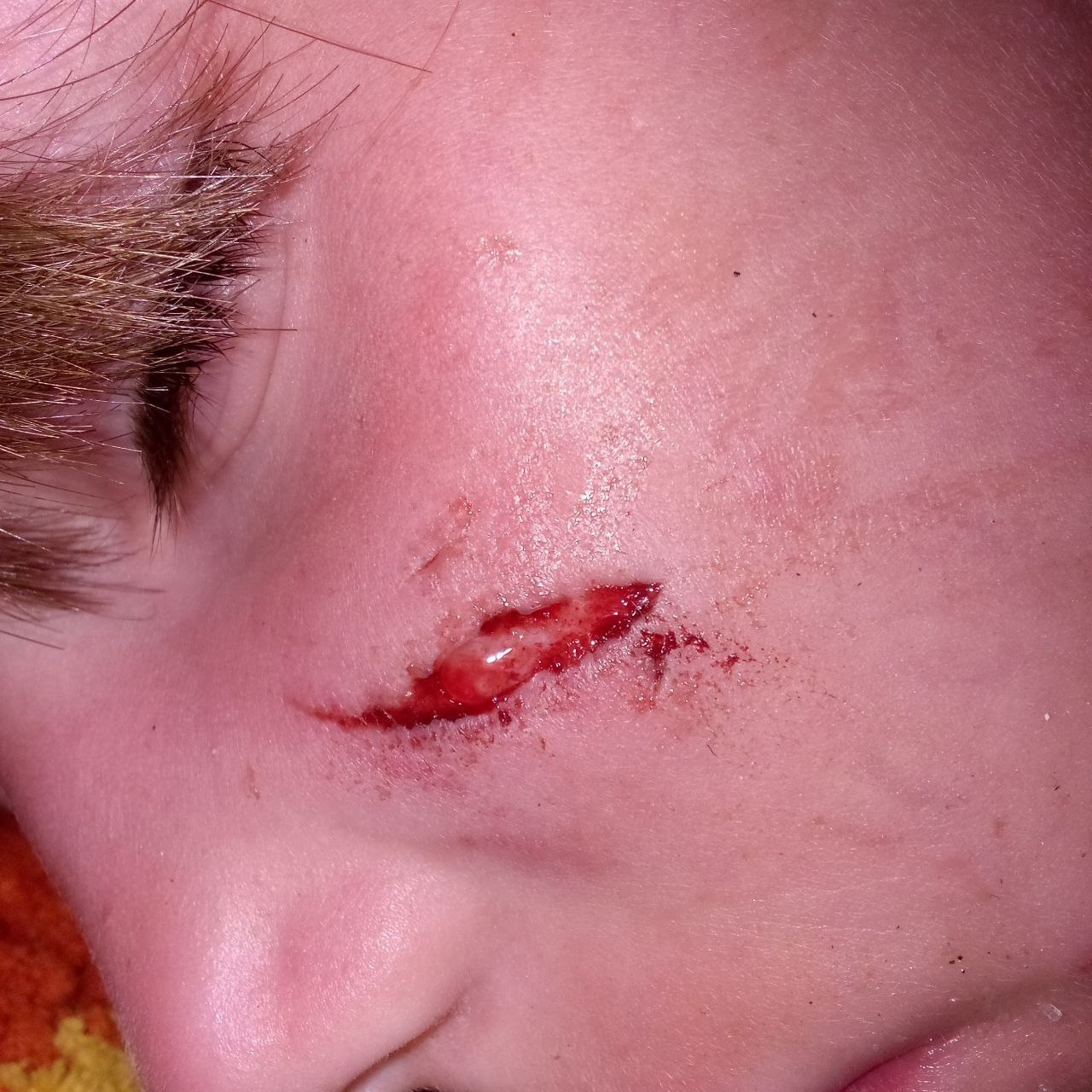 На Южном Урале ребёнок попал в больницу после нападения бездомных собак